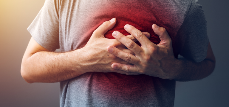 Heart attack - definition, symptoms and co.